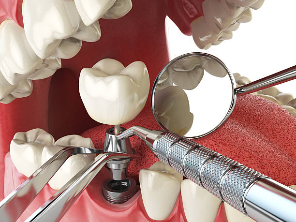 Best Emergency Treatment for Dental Infections or Abscesses in Woodfin, NC